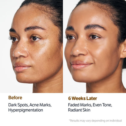 ✨Last 3 Hours 50% OFF  ✨ BUY 2 GET 2 FREE🔥SONGBOON Editor Glass Skin Collagen Volufiline Cream-in-Serum | Gentle, Nourishing &Comfort Korean Skincare Moisturizer for Firming & Hydrating