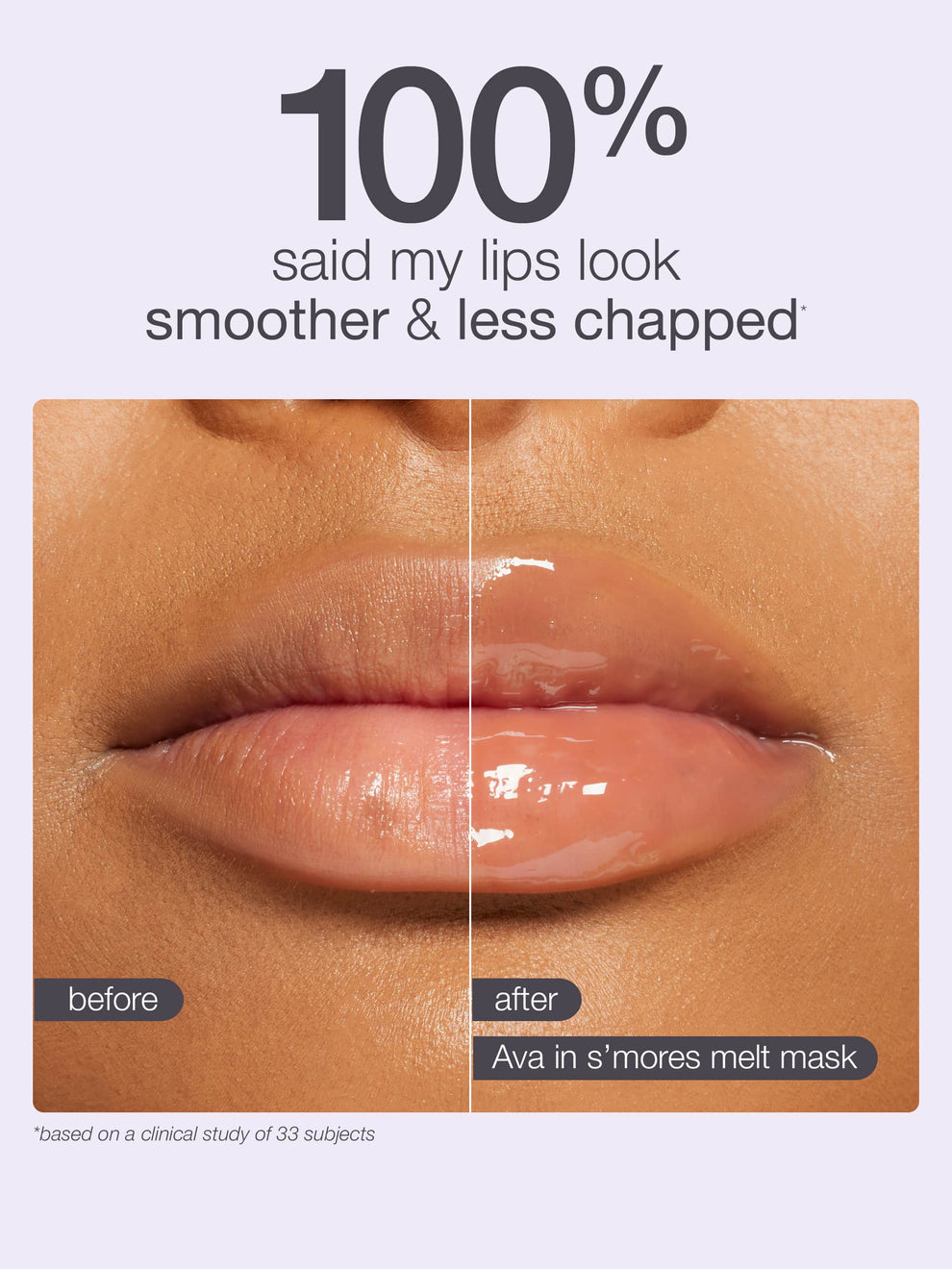 🧊Last 3 hours 70% off!⏰Holiday Sweetness: 5 New Lippies + 3 FREE! 🎁 Maracuja Juicy Lip Gloss Set – Your Perfect Gift!