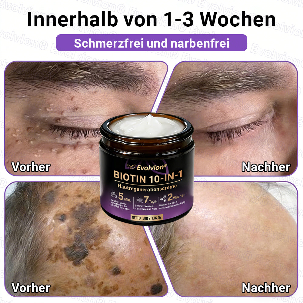 Hergestellt und versendet aus Deutschland ✨ Evolvion® Biotin 10-in-1 Hautrestaurationscreme
