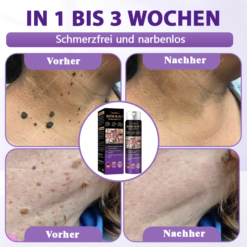Hergestellt und versandt aus Deutschland ✨Evolvion® Biotin 10-in-1 Hautregenerations-Spray