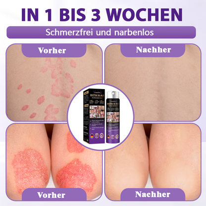 Hergestellt und versandt aus Deutschland ✨Evolvion® Biotin 10-in-1 Hautregenerations-Spray