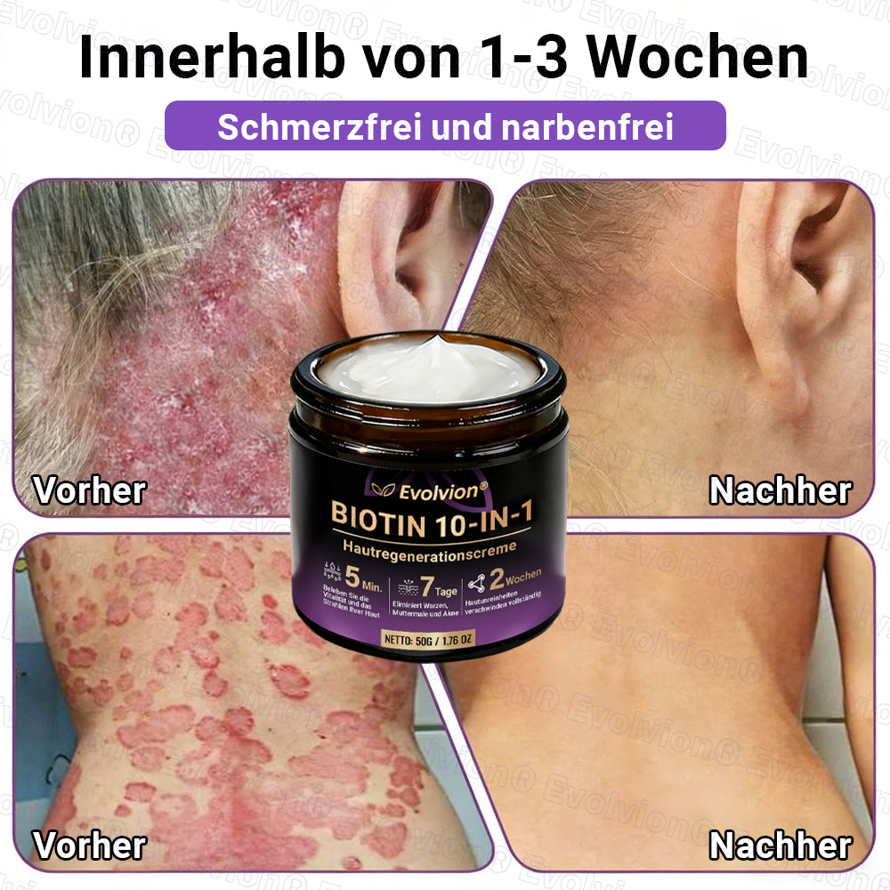 Hergestellt und versendet aus Deutschland ✨ Evolvion® Biotin 10-in-1 Hautrestaurationscreme
