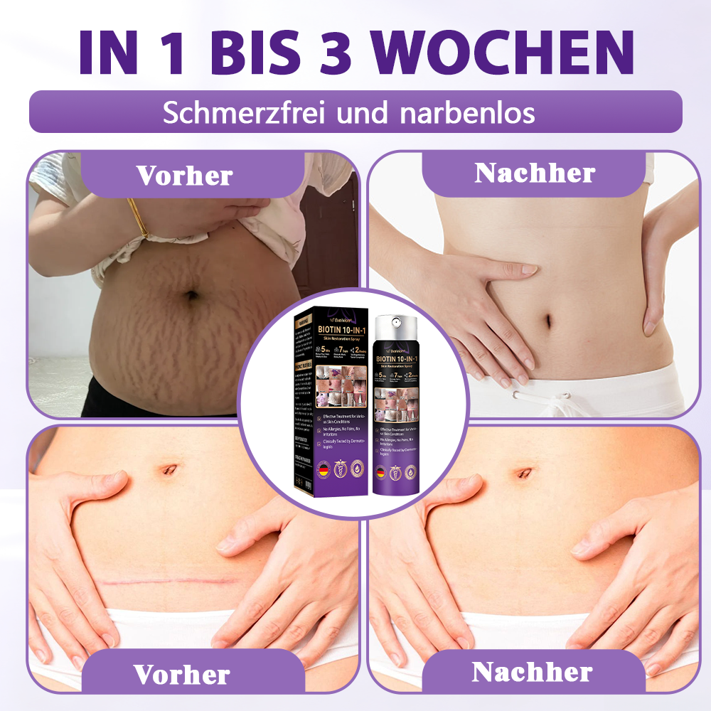 Hergestellt und versandt aus Deutschland ✨Evolvion® Biotin 10-in-1 Hautregenerations-Spray