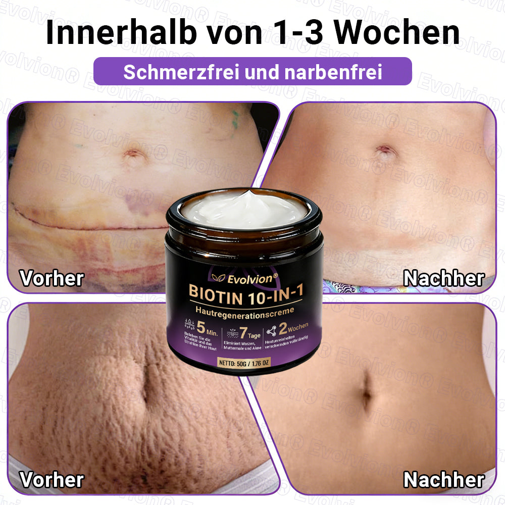 Hergestellt und versendet aus Deutschland ✨ Evolvion® Biotin 10-in-1 Hautrestaurationscreme