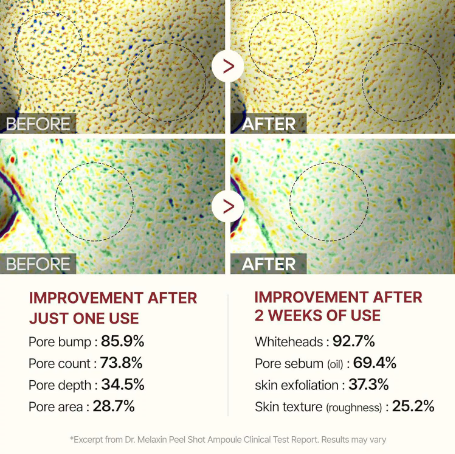 Final 3 Hours: 70% OFF🔥 Gentle Exfoliator Glow Rice Ampoule-Suitable for All Skin Types