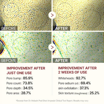 Final 3 Hours: 70% OFF🔥 Gentle Exfoliator Glow Rice Ampoule-Suitable for All Skin Types