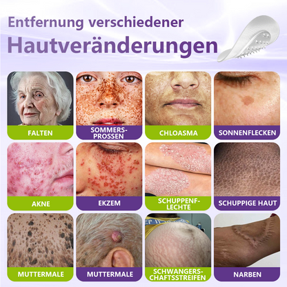 GFOUK® Lösliches Mikronadel-Pflaster zur Entfernung von Hautanhängseln auf Pflanzenbasis
