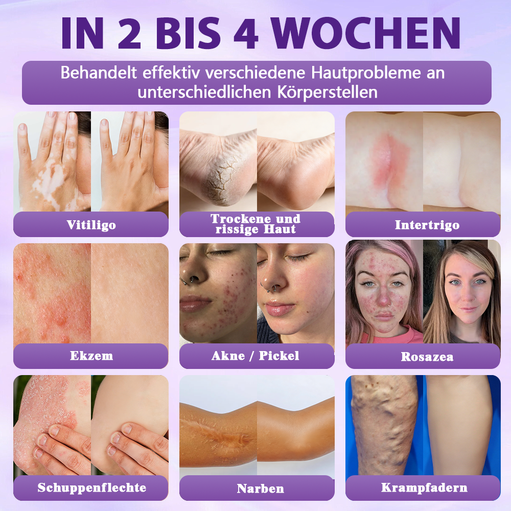 Hergestellt und versandt aus Deutschland ✨Evolvion® Biotin 10-in-1 Hautregenerations-Spray