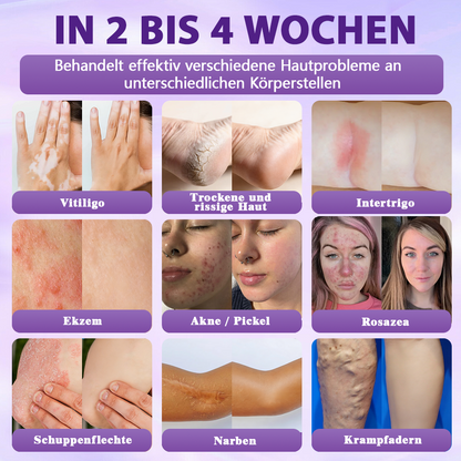 Hergestellt und versandt aus Deutschland ✨Evolvion® Biotin 10-in-1 Hautregenerations-Spray
