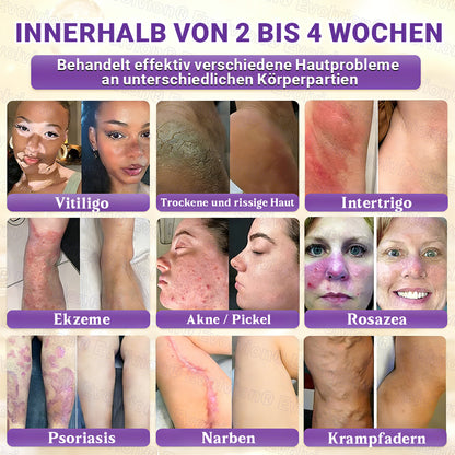 Hergestellt und versendet aus Deutschland ✨ Evolvion® Biotin 10-in-1 Hautrestaurationscreme