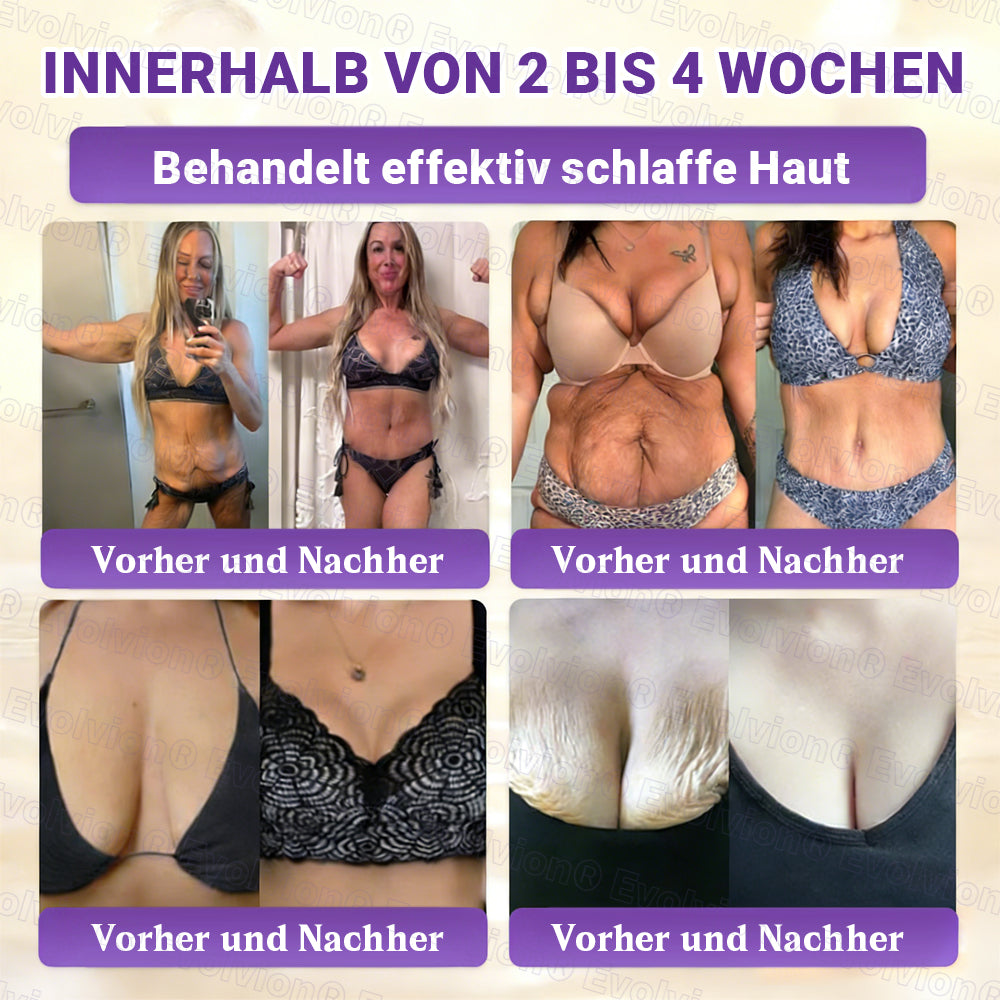 Hergestellt und versendet aus Deutschland ✨ Evolvion® Biotin 10-in-1 Hautrestaurationscreme