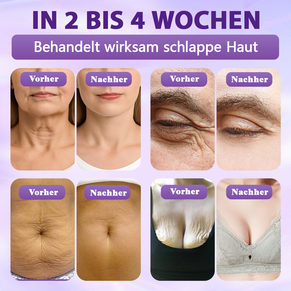 Hergestellt und versandt aus Deutschland ✨Evolvion® Biotin 10-in-1 Hautregenerations-Spray