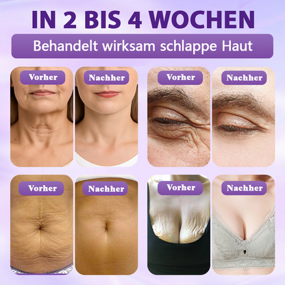 Hergestellt und versandt aus Deutschland ✨Evolvion® Biotin 10-in-1 Hautregenerations-Spray