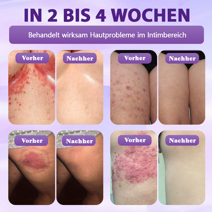 Hergestellt und versandt aus Deutschland ✨Evolvion® Biotin 10-in-1 Hautregenerations-Spray