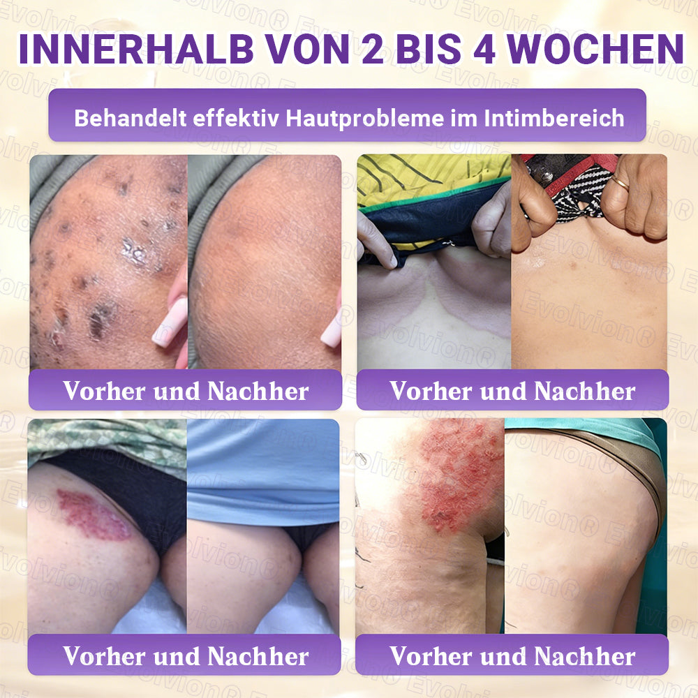 Hergestellt und versendet aus Deutschland ✨ Evolvion® Biotin 10-in-1 Hautrestaurationscreme