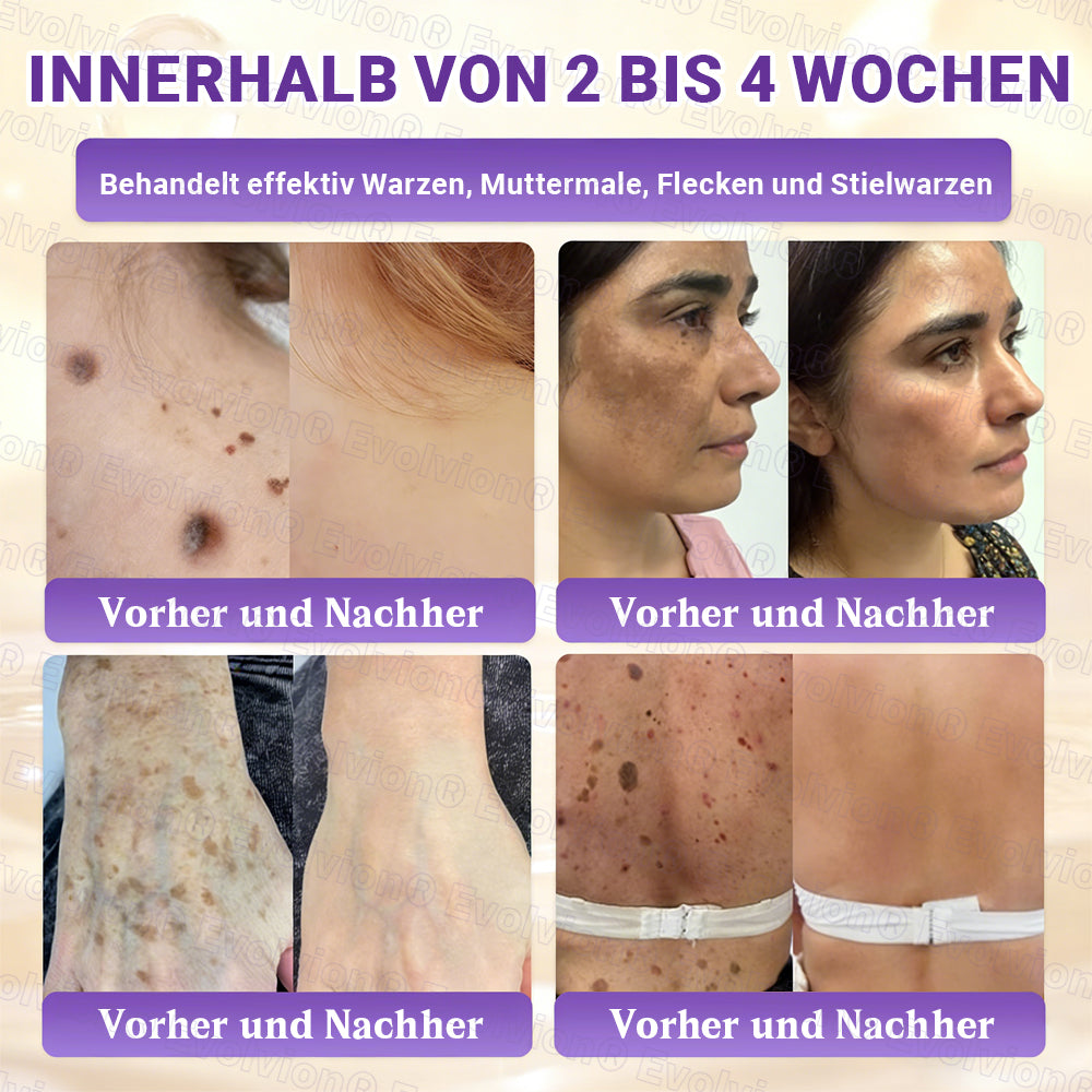 Hergestellt und versendet aus Deutschland ✨ Evolvion® Biotin 10-in-1 Hautrestaurationscreme