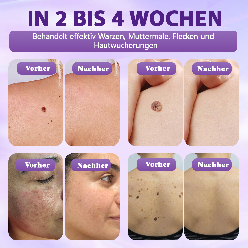 Hergestellt und versandt aus Deutschland ✨Evolvion® Biotin 10-in-1 Hautregenerations-Spray