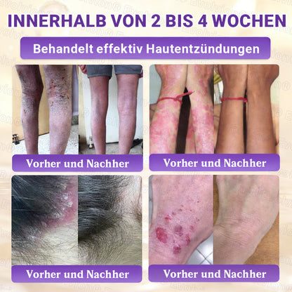 Hergestellt und versendet aus Deutschland ✨ Evolvion® Biotin 10-in-1 Hautrestaurationscreme
