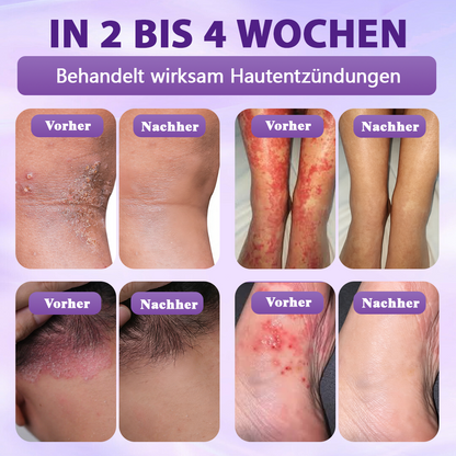 Hergestellt und versandt aus Deutschland ✨Evolvion® Biotin 10-in-1 Hautregenerations-Spray