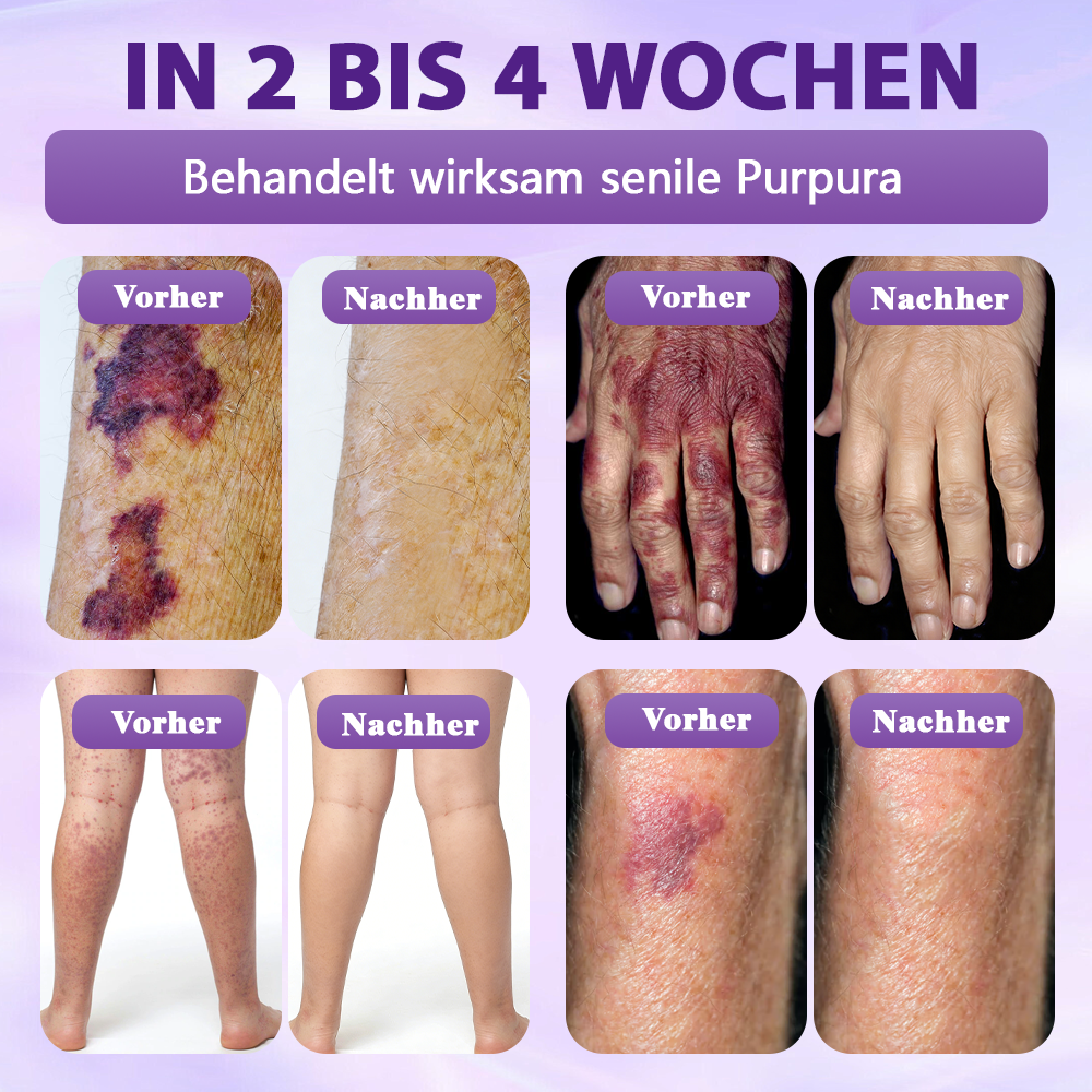 Hergestellt und versandt aus Deutschland ✨Evolvion® Biotin 10-in-1 Hautregenerations-Spray