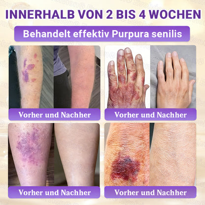 Hergestellt und versendet aus Deutschland ✨ Evolvion® Biotin 10-in-1 Hautrestaurationscreme
