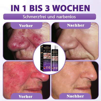 Hergestellt und versandt aus Deutschland ✨Evolvion® Biotin 10-in-1 Hautregenerations-Spray