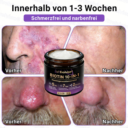 Hergestellt und versendet aus Deutschland ✨ Evolvion® Biotin 10-in-1 Hautrestaurationscreme