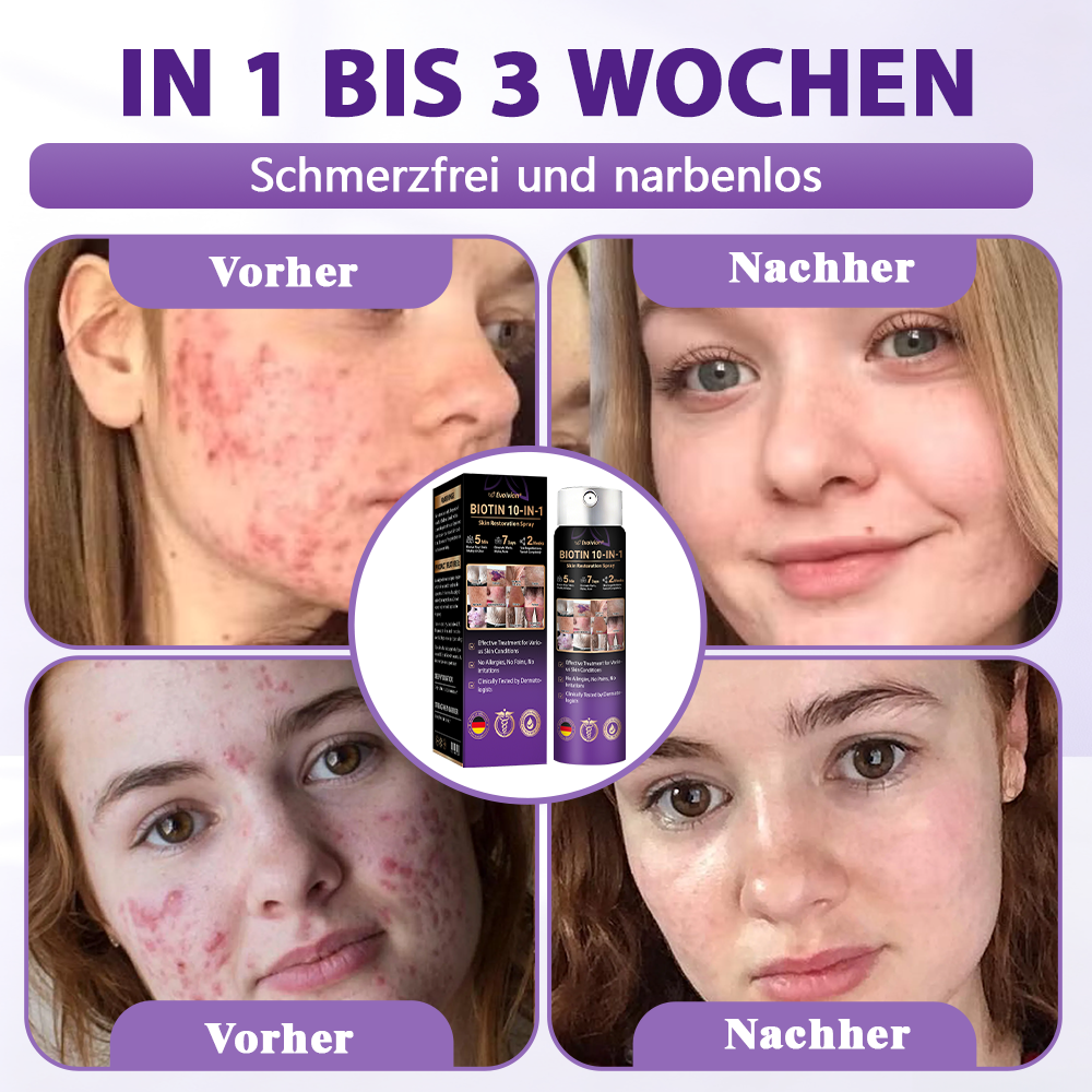 Hergestellt und versandt aus Deutschland ✨Evolvion® Biotin 10-in-1 Hautregenerations-Spray
