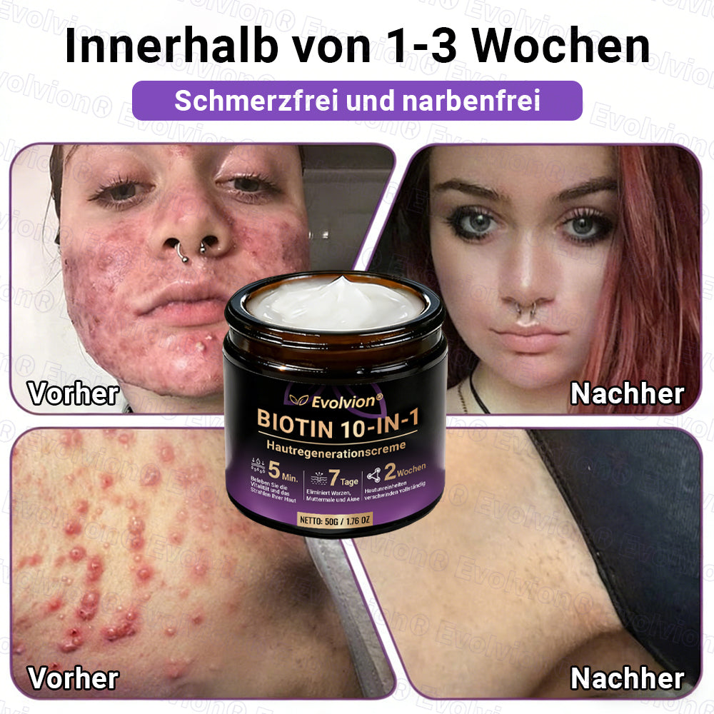 Hergestellt und versendet aus Deutschland ✨ Evolvion® Biotin 10-in-1 Hautrestaurationscreme