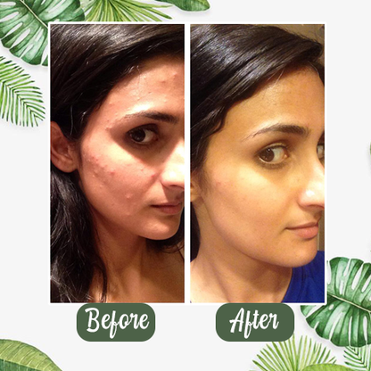 🔥LAST DAY SALE-80% OFF)Final Sale -Insideefy Holy Basil Bubble Deep Mask 13%