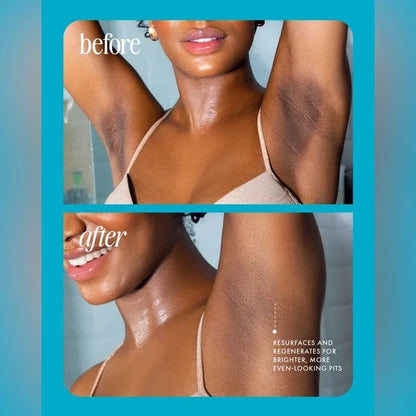 ⚡️ 5-Second Post-Hair Removal Rescue: Bumps Fade, Skin Glows! Glass Smooth Oil.